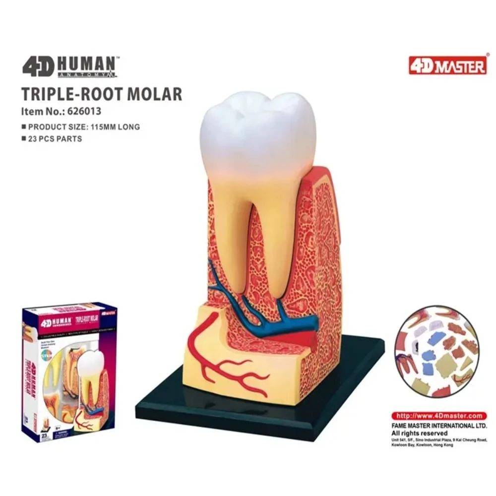 4D Human Anatomy Triple-Root Molar - Medical Educational Model with 23 Removable Parts and Exchangeable Decay Sections